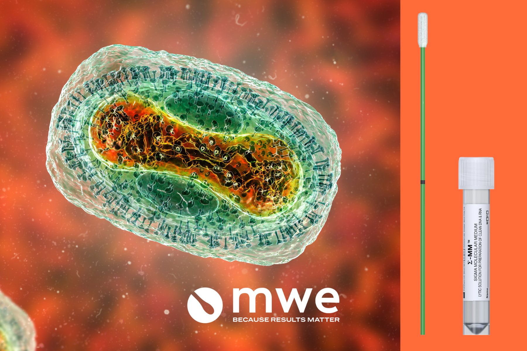 Mpox virus with SIGMA MM™ and Soft Touch Foam Swab